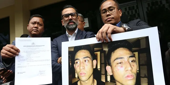 Setelah Dianiaya Oknum Polisi, Axel Thomas Jadi Tersangka Narkoba