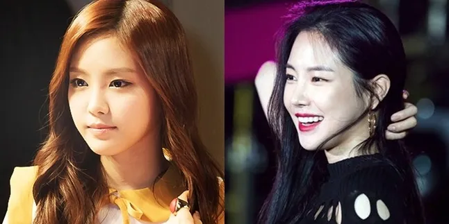 Setelah Namjoo, Kini Naeun A Pink Diduga Lakukan Operasi Plastik