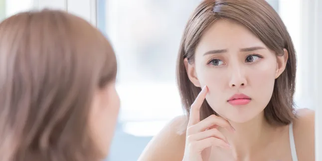 Stop Panik Pas Jerawatan! Ini Cara Lembut Atasi Jerawat Tanpa Bikin Drama