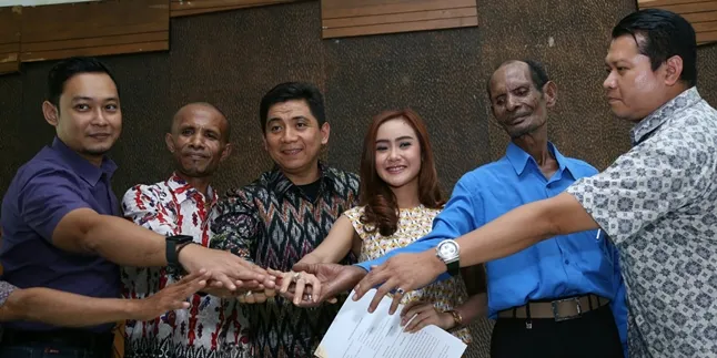 Sudah Damai, Delik Aduan Untuk Cita Citata Belum Dicabut