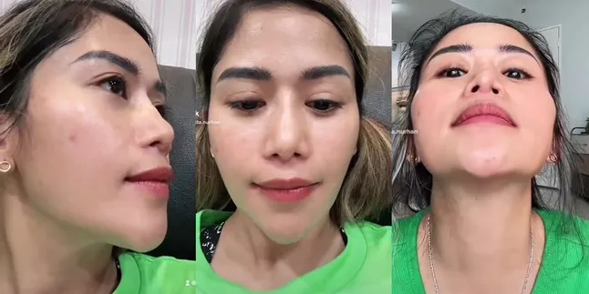 Lubang Hidungnya Kecil Sebelah, Ini 7 Potret Farida Nurhan yang Lakukan Oplas sampai 3 Kali - Akui Tak Kesulitan Bernapas