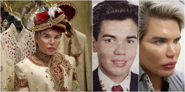 Terobsesi Boneka Ken, Seorang Pria Oplas Mata Meski Berisiko Buta