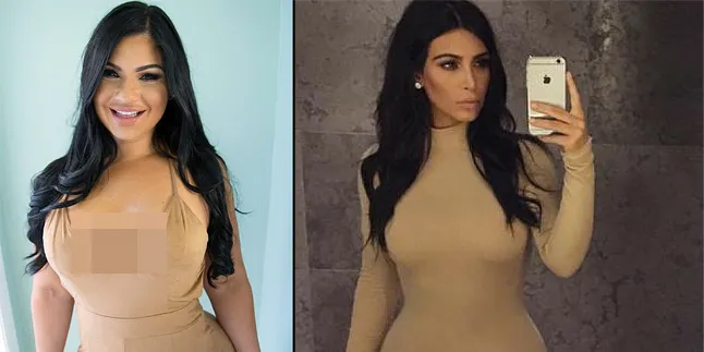 Terobsesi Mirip Kim Kardashian, Cewek Ini Lakukan Operasi Plastik