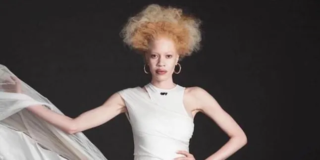 Unik dan Berbeda, Inilah Deretan Model Dunia yang Dobrak Standart Kecantikan