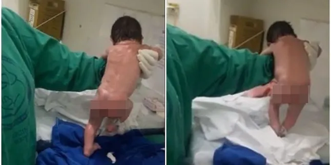 Viral, Bayi Ini Langsung Berjalan Sesaat Setelah Dilahirkan