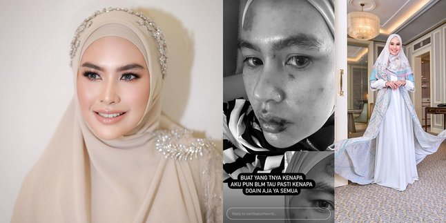 Blistered Face and Tongue, Here are 8 Photos of Kartika Putri with a Mysterious Disease - Decided to Seek Treatment in Singapore