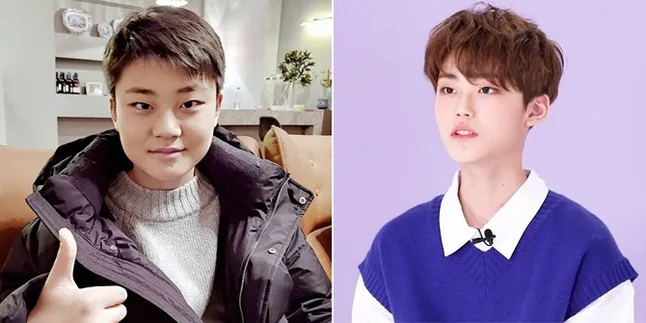 Wajah Lee Eugene 'SKY CASTLE' Berubah Drastis Usai 'PRODUCE X 101', Netizen Shock! Wajah Lee Eugene 'SKY CASTLE' Berubah Drastis Usai 'PRODUCE X 101', Netizen Shock!