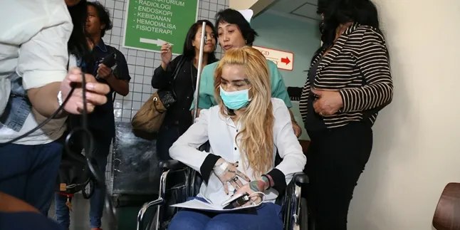 Wajah Terluka, Sheila Marcia Tunggu Second Opini Terkait Operasi