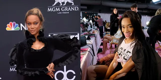 Winnie Harlow Anggap ANTM Tak Beri Kontribusi Karirnya, Ini Tanggapan Tyra Banks