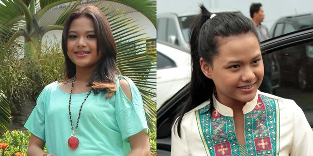 Wow! Aurel Berpose Bak Super Model