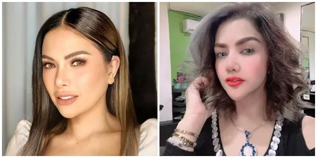 9 Portraits Before - After Celebrities Do Plastic Surgery, Some Are