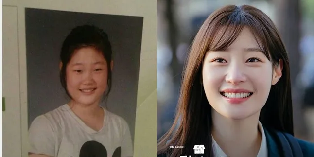 Potret Cantik Jung Chaeyeon Disebut Punya Hasil Operasi Plastik Paling Natural, Akui Memang Oplas
