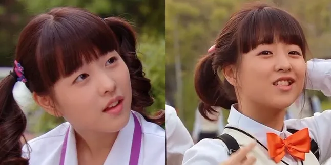 Park Bo Young Teeth Veneers