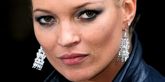 Tak Bisa Hindari Rokok, Kate Moss Pilih Hipnotis