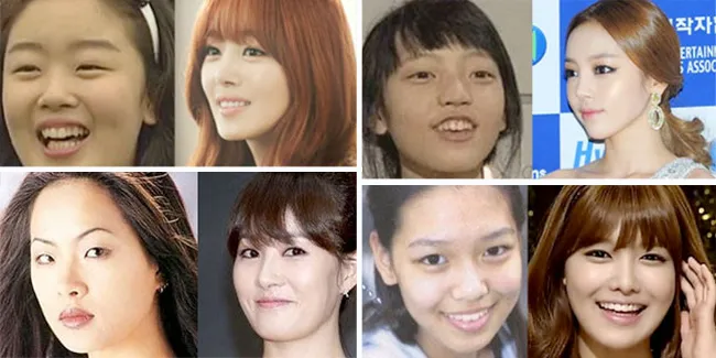 10 Foto Masa Lalu Seleb Korea Yang Berubah Drastis!