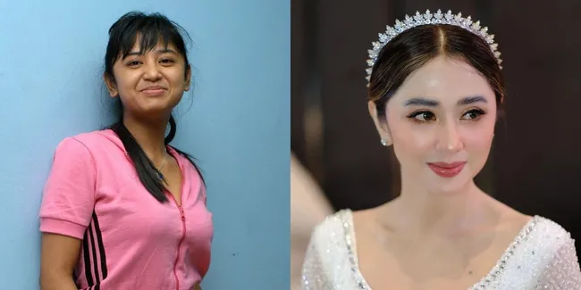 11 Transformasi Artis Setelah Tanam Benang, Ada yang Langsung Mirip Idol Korea