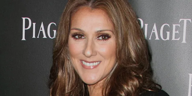 Setelah Nicole Kidman, Celine Dion Ikut Topless