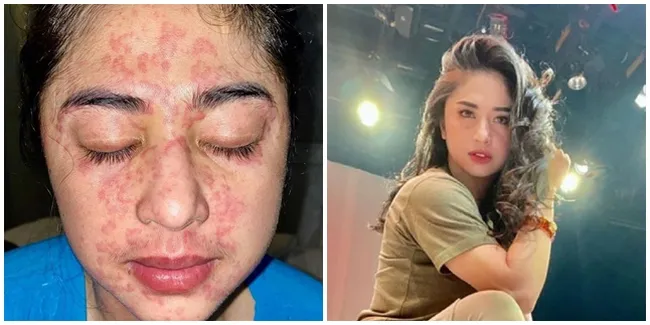 Dewi Perssik Beberkan Kronologi Terkena Covid, Ternyata Positif Bersama 8 Orang lainnya