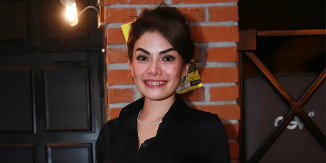 [FOTO] Bibir Mendadak Tebal, Nikita Mirzani Saingi Angelina Jolie