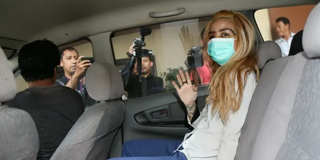 Meski Lebam di Wajah, Sheila Marcia Pilih Pulang Pasca Kecelakaan