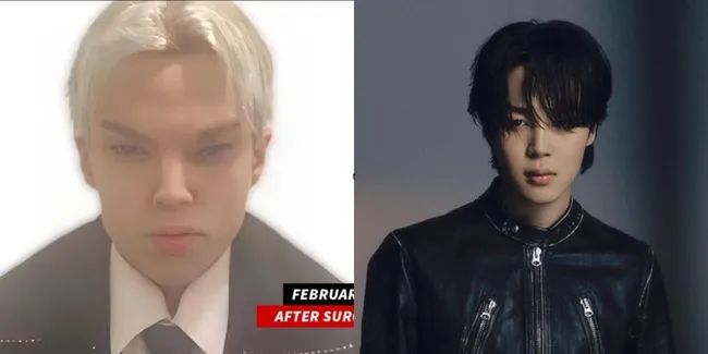 Obsesi Memiliki Wajah Seperti Jimin BTS, Aktor Asal Kanada Ini Meninggal Usai Operasi Plastik Sebanyak 12 Kali