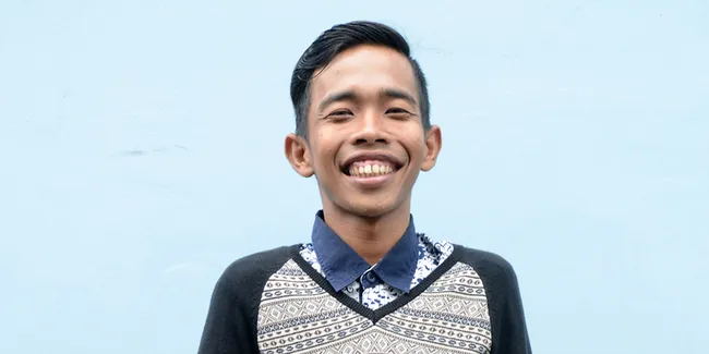 Putra Dede Sunandar Sudah Menigdap Williams Syndrome Sejak Usia 3 Bulan