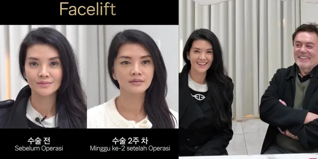 Putuskan Lakukan Operasi Plastik, Perubahan Wajah Farah Quinn Kini Jadi Lebih Terlihat Muda