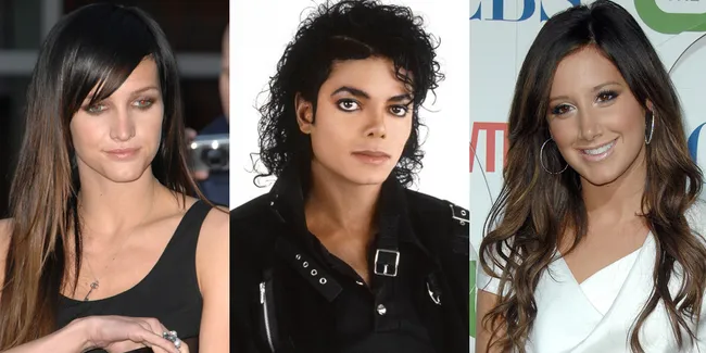 Salah Prosedur Operasi, Hidung Artis-Artis Ini Malah Terlihat...