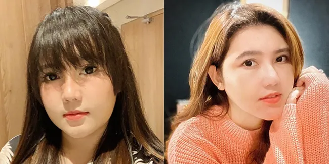 10 Potret Terbaru Via Vallen yang Makin Tirus dan Cantik, Sempat Dihujat Gara-Gara Punya Pipi Tembem