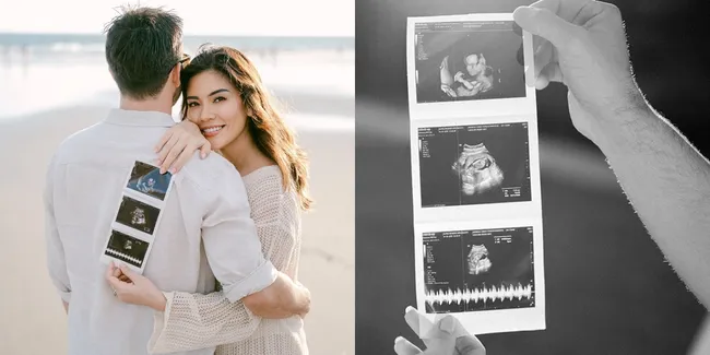 7 Potret Aline Adita Hamil Setelah 7 Tahun Program Bayi Tabung, Bahagia Ungkap Rasa Syukur