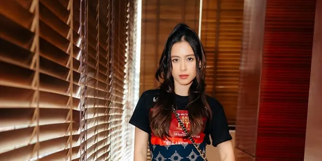 7 Potret Laura Theux Alami Insiden di Lokasi Syuting, Tetap Profesional Meski Kaki Lebam