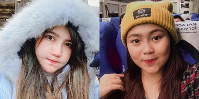 8 Pesona Pedangdut Cantik Pemilik Pipi Tembem, Imut dan Menggemaskan