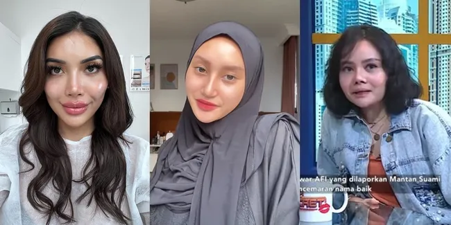 8 Potret Artis yang Percantik Dirinya dengan Operasi, Terbaru Millen Cyrus Bak Angelina Jolie - Hidung Mawar AFI Runcing Makin Aneh