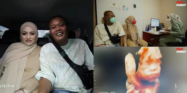 8 Potret Nathalie Holscher Periksa Kandungan Ditemani Sule, Foto USG Sang Buah Hati Disebut Mirip Banget Ayahnya!