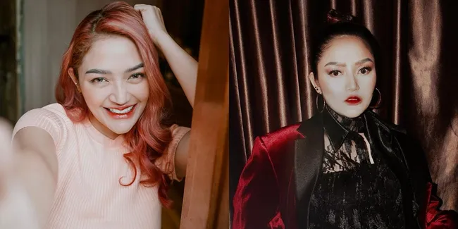 8 Potret Siti Badriah yang Dituding Lakukan Operasi Plastik, Kini Makin Cantik dan Langsing -  Akui Hanya Filler Bibir dan Rapikan Gigi