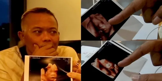 9 Potret Hasil USG Nathalie Holscher yang Bikin Nangis Sule: Soalnya Mirip Saya!