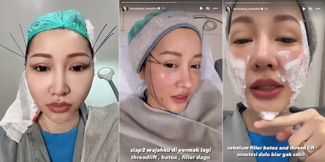 9 Potret Lucinta Luna yang Wajahnya Dipermak Lagi, Tarik Benang Demi Mirip Jennie Blackpink - Netizen Sebut Nggak Ada Puasnya