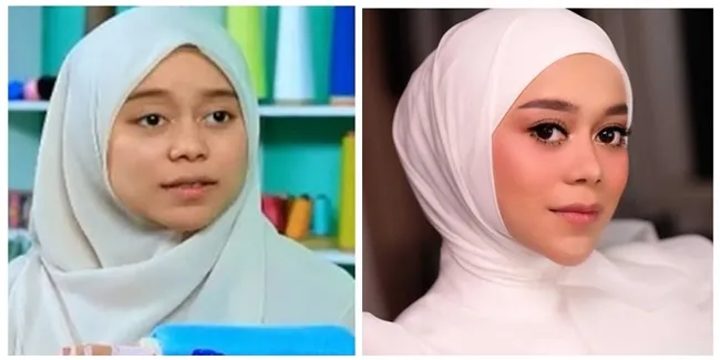 9 Potret Sebelum & Sesudah Para Penyanyi Ini Lakukan Tanam Benang, Pipi Makin Tirus - Pede Bertambah