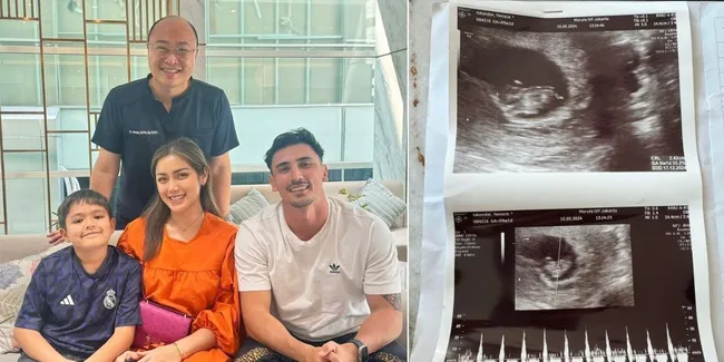 Bukan Karena Kesulitan Hamil Atau Tak Subur, 8 Potret Dokter Ungkap Alasan Spesifik Jessica Iskandar dan Vincent Verhaag Jalani Program Bayi Tabung