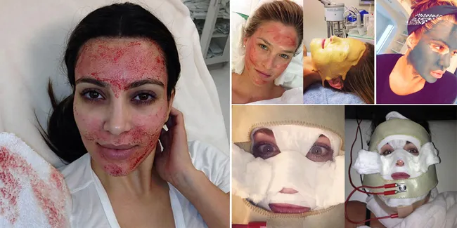 Dari Darah Hingga Disetrum Listrik, Ini Rahasia Cantik Mereka