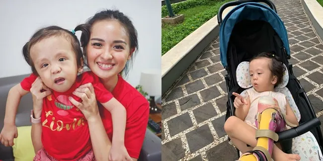 Derita Penyakit Langka Sejak Lahir, 9 Potret Ziona Anak Joanna Alexandra Kini Mulai Bisa Jalan - Dianggap Sebagai Keajaiban