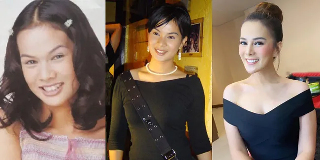 Dituding Operasi Plastik, Ini 10 Potret Transformasi Astrid Tiar Dari Mulai Wajah Polos Sampai Kini Punya Hidung Mancung dan Dagu Lancip