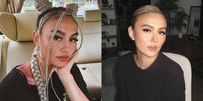 Dulu Dituding Oplas, Potret Terbaru Agnez Mo Yang Ramai Disorot Netizen - Wajahnya Dianggap Kurang Natural