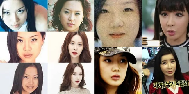 FOTO: 6 Selebriti Korea Yang Dianggap Ketagihan Operasi Plastik