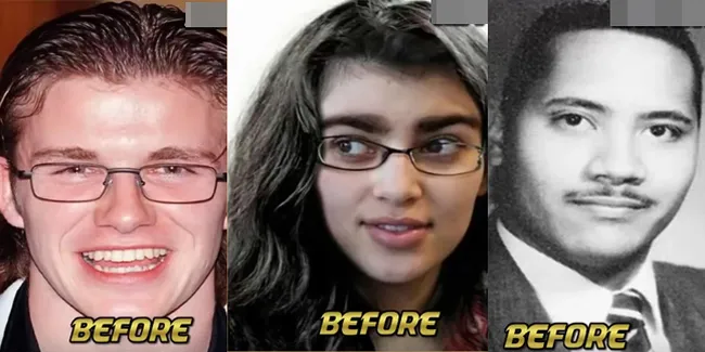 FOTO: Before & After Selebriti Papan Atas Dunia, Bikin Melongo!
