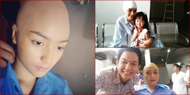 FOTO: Citra Kirana Kena Tumor dan Rambut Digundul
