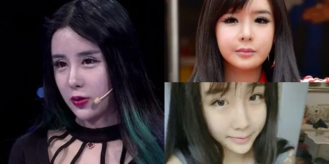 FOTO: Gadis China 16 Tahun Lakukan Oplas, Kini Mirip Bom 2NE1?