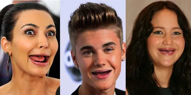 FOTO: Sederet Selebriti Ini Diedit Jadi Ompong, Bikin Ngakak!