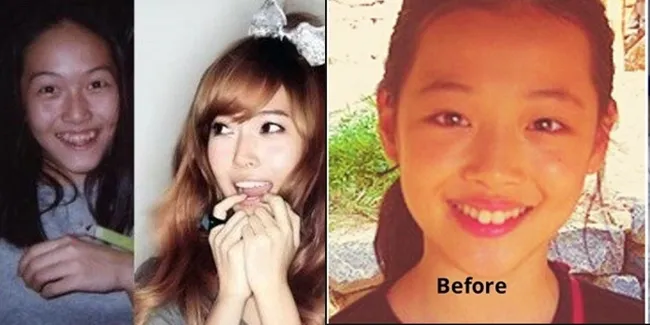 FOTO: Ups! Bintang-Bintang Korea Ini Punya Gigi Yang Buruk