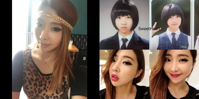 Galeri Perubahan Wajah Minzy 2NE1 Dari Tahun ke Tahun, Oplas?